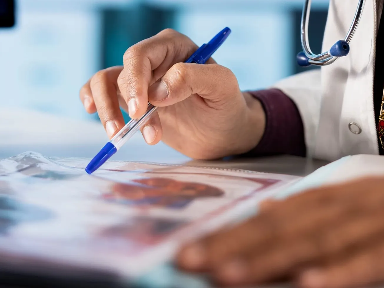 Un estudio genético relaciona la ascendencia con la gravedad de la enfermedad inflamatoria intestinal en hispanos