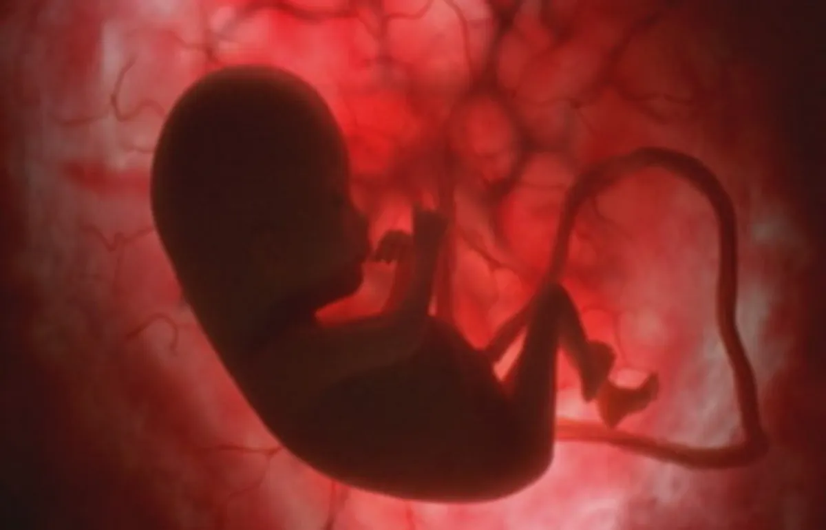 aborto en Arizona