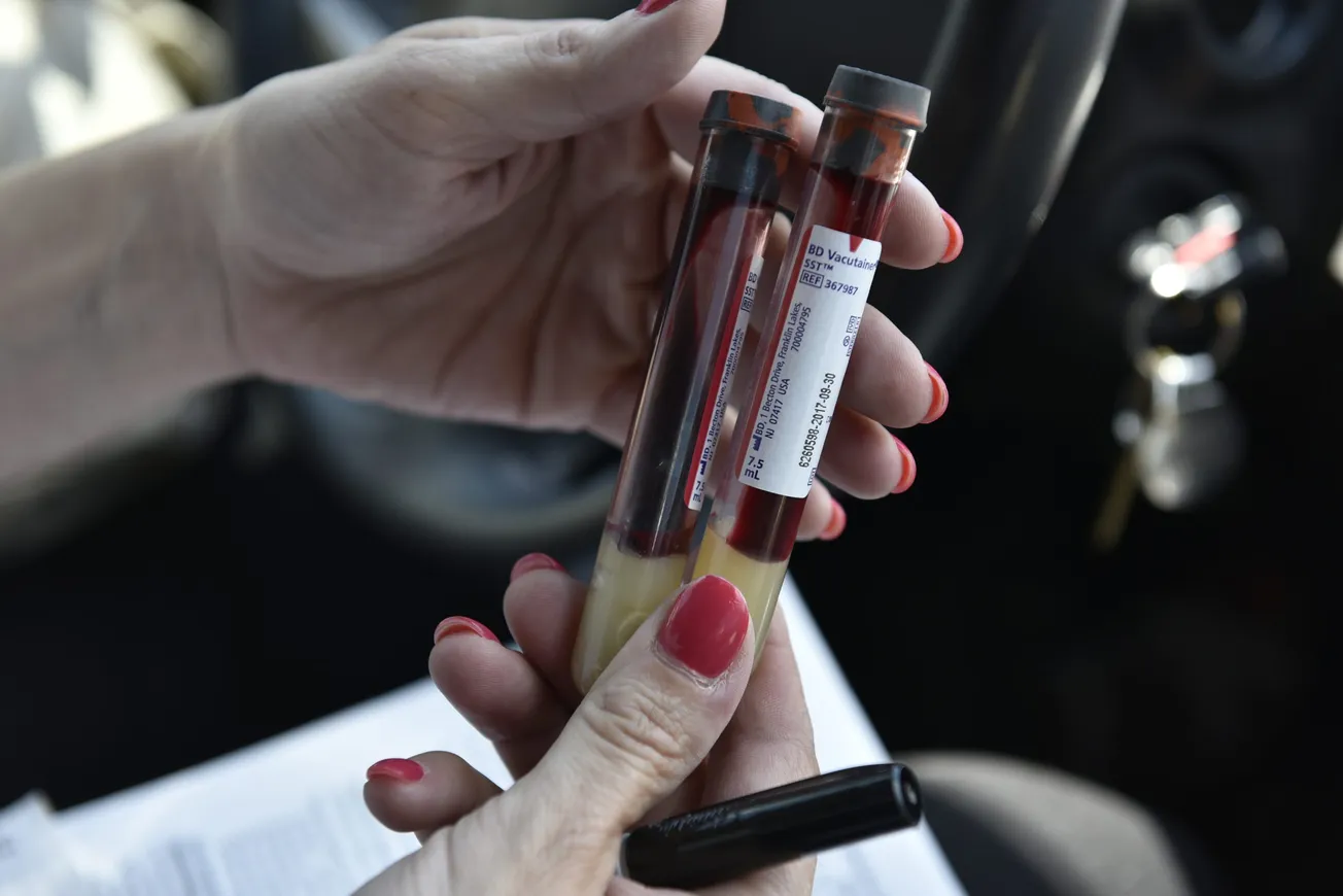 Brote de sífilis en Houston es una crisis de salud pública