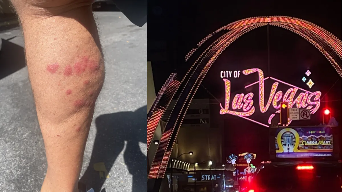 Chinches Las Vegas