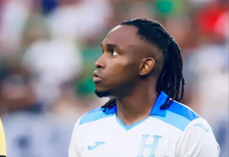 Alberth Elis es operado tras sufrir un golpe de cabeza en el Burdeos-Guingamp